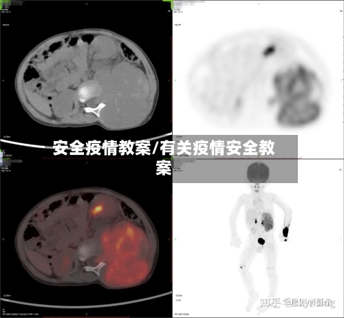 安全疫情教案/有关疫情安全教案-第2张图片